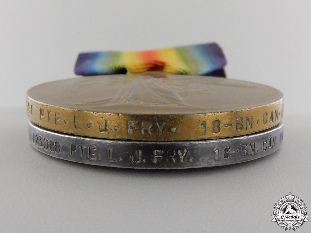 a_first_war_pair_to_the18_th_canadian_infantry_cef_img_03.jpg5564a1092dffc